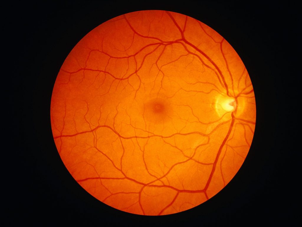 Best 5 ways for retinal photography
