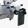 smartphone-adaptor-for-surgical-microscope