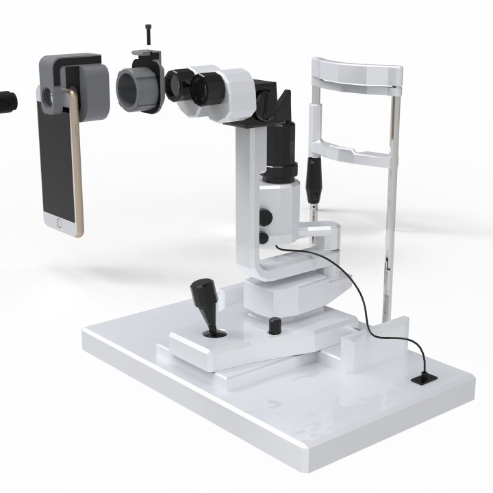 All-fit Smartphone adapter for slitlamps and surgical microscopes